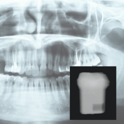 Röntgenopakes Material 3D Druck