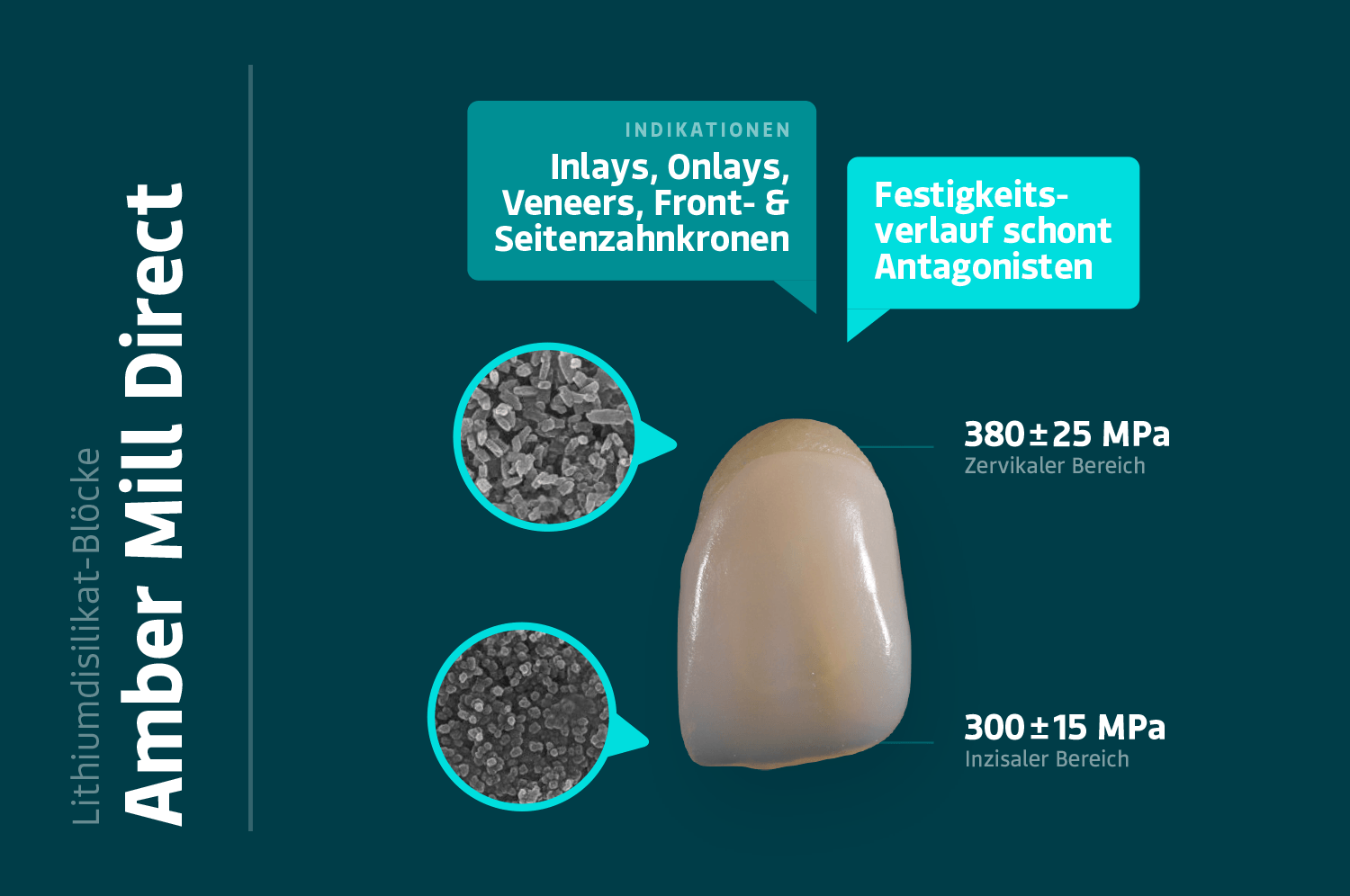 Amber Mill Direct – Festigkeitsverlauf schont Antagonisten