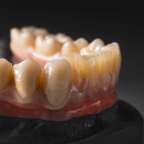 Sagemax Zirkon transluzent Multi | NexxZr T Multi Normal | W-98 C3 16 mm