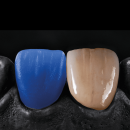 Sagemax Press and Cast | Wax Disc Normal | W-98 14 mm