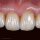 HASS Amber Press | Lithiumdisilikat-Pellets | R10 mm | LT | 5er-Pack W1
